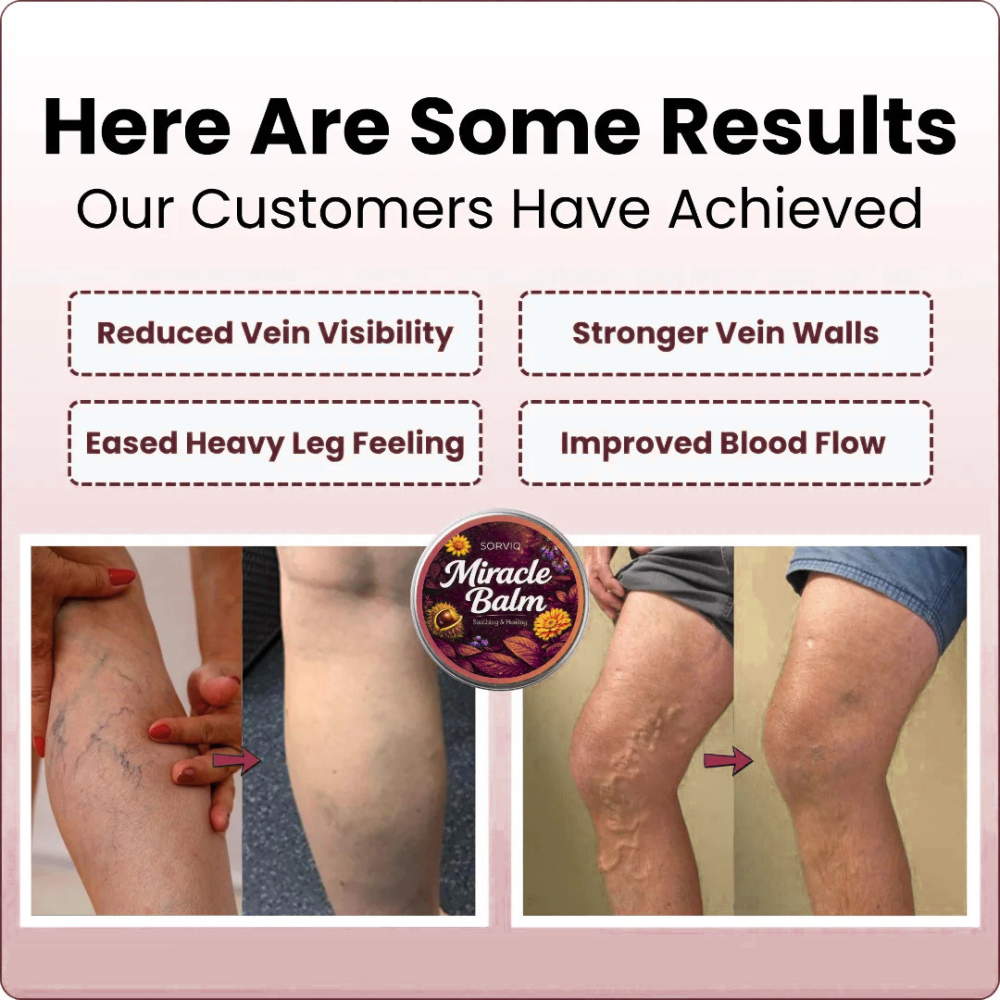 Reliefora VeinRenew Gel